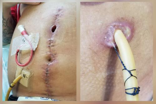 abdomen-2