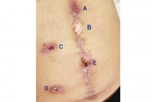abdomen